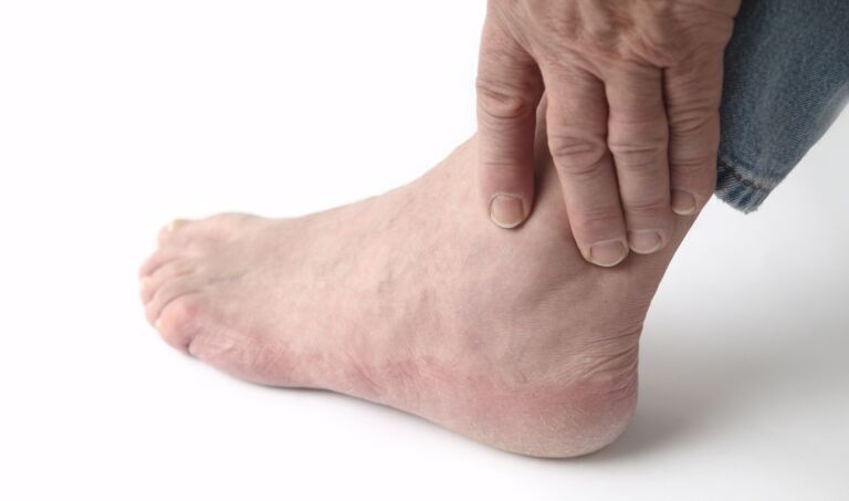 Solutions for Foot and Ankle Arthritis